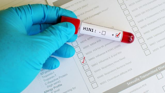 აჭარაში H1N1-ით გარდაცვალების კიდევ ერთი შემთხვევა დადასტურდა