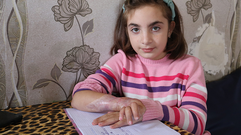 9 წლის ანიტას ხელზე სატვირთომ გადაუარა, მას თურქეთში ოპერაცია სჭირდება 